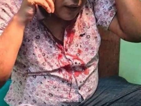 अज्ञात समूह द्वारा अनेरास्ववियूका केन्द्रीय सदस्य सागरहरी अधिकारी माथी  सांघतिक आक्रमण